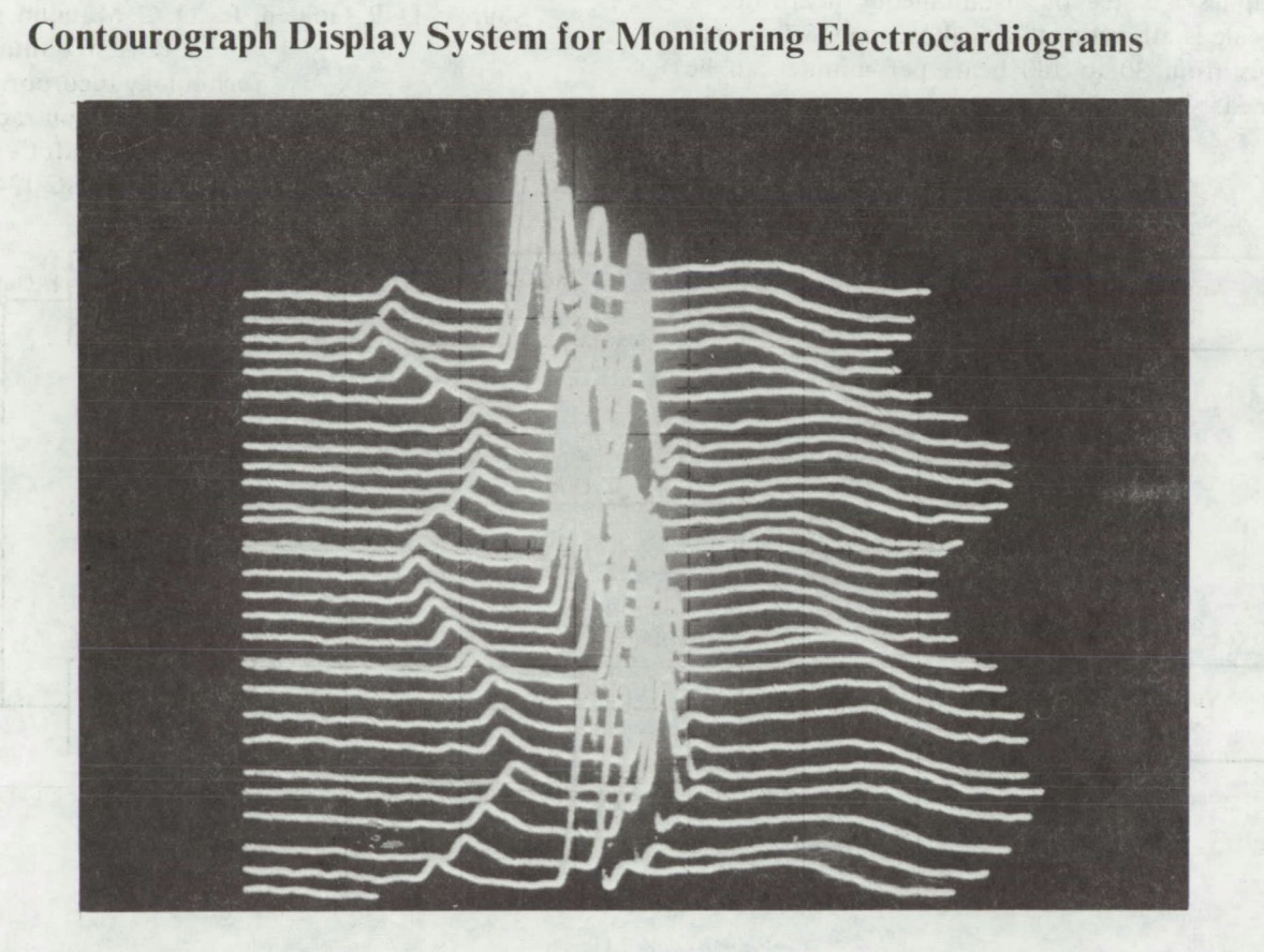 This is not really what it looked like. Imagine the display fading as it slowly moved down the screen.